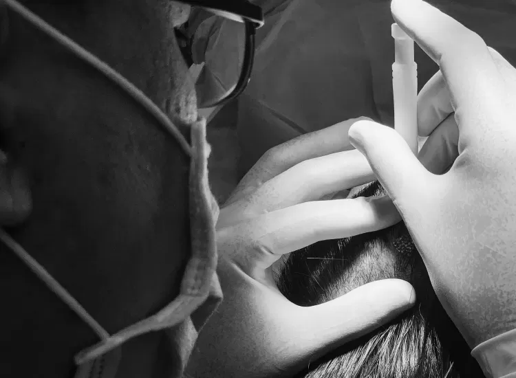 Doctor explaining hair transplant success rates and potential risks to a patient during consultation at a leading clinic in Malaysia.