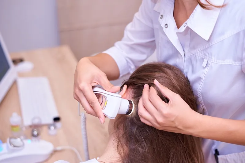 Women Hair Loss Malaysia