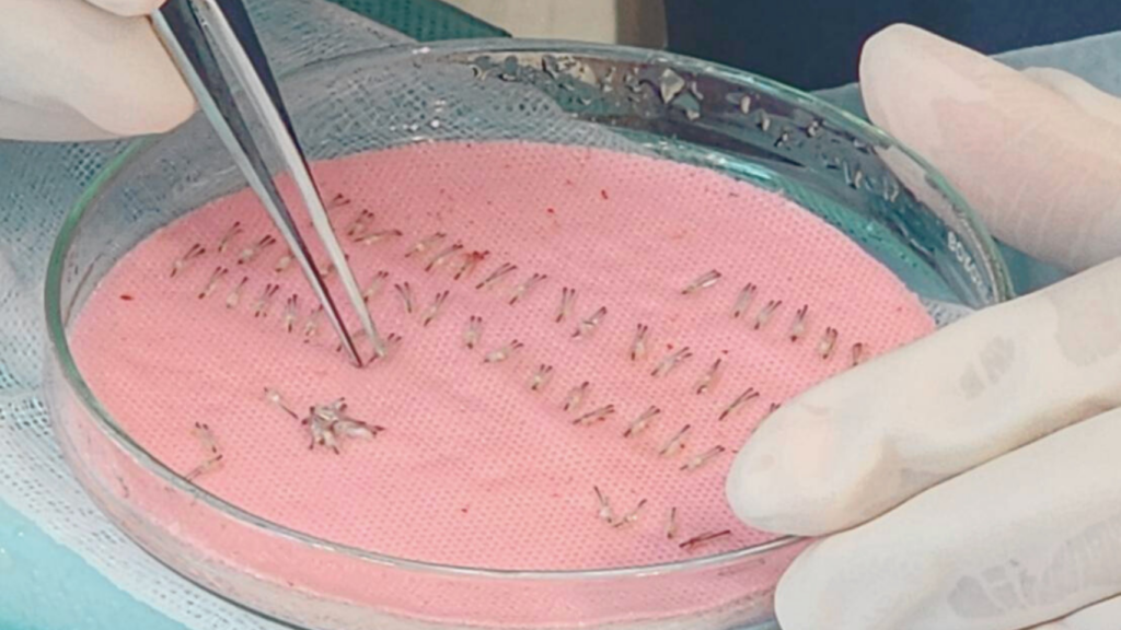 Modern interior of the best hair transplant clinic in Malaysia