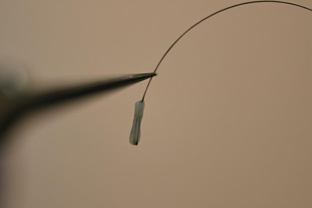 Hair Graft Preparation Healthy hair grafts before implantation in hair transplant procedure